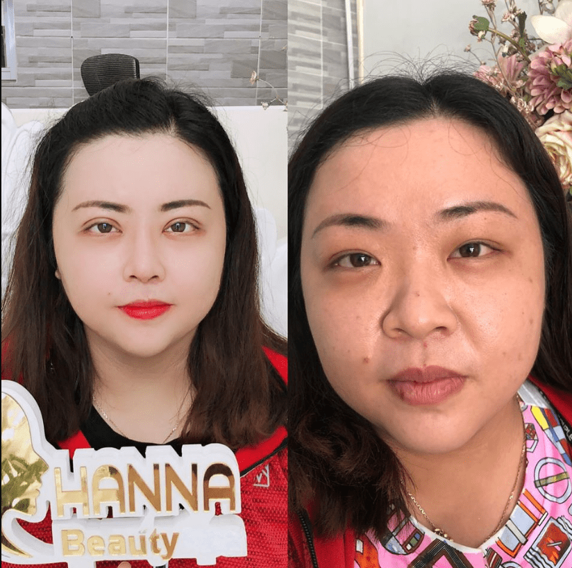 thẩm mỹ viện Sài Gòn bệnh viện làm đẹp tp hcm