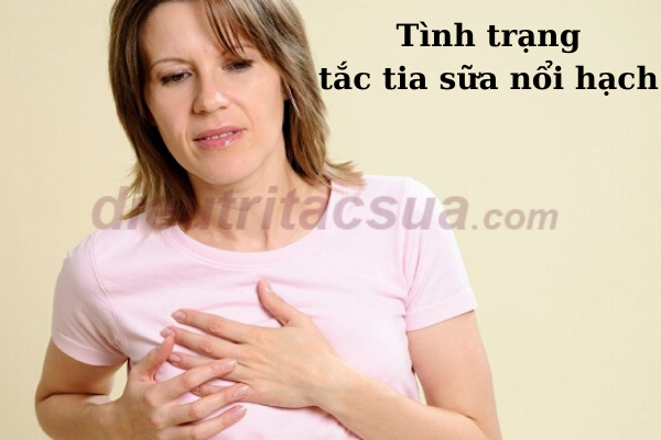 Tình trạng tắc tia sữa nổi hạch 