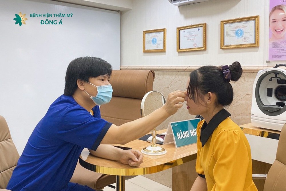 lưu ý khi nâng nâng cao sống mũi