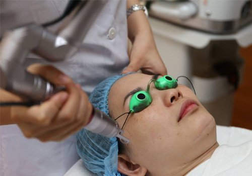 trị nám bằng tia laser giá bao nhiêu tiền