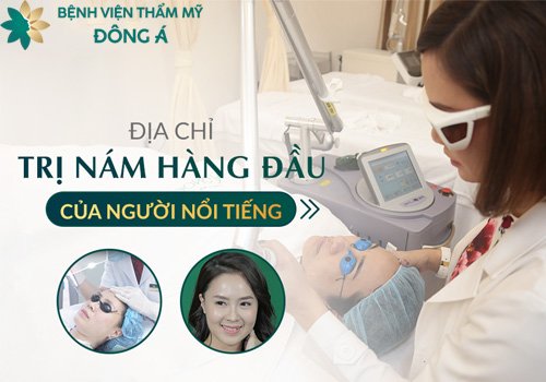trị nám hết bao nhiêu tiền