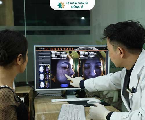 trị nám tàn nhang tốt