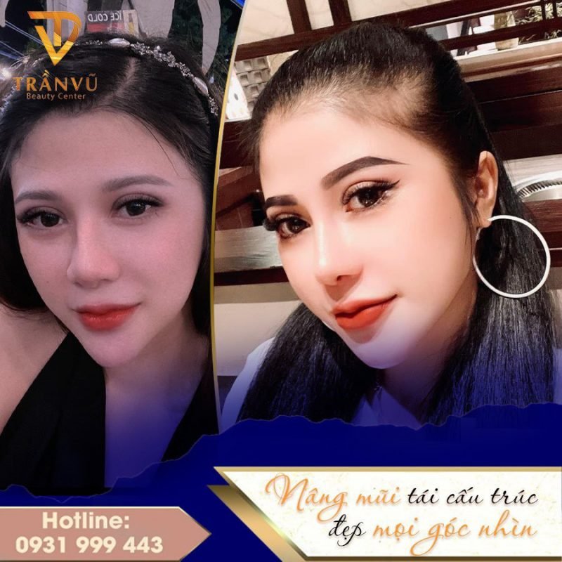 Thẩm Mỹ Trần Vũ